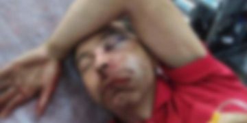 BĂRBAT DIN DÂMBOVIȚA BĂTUT CU BESTIALITATE DE DOI MINORI