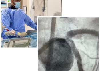 Dr. Țoni Ovidiu și dr. Andrei Issa au realizat o procedură de vârf DK-Crush la Spitalul Județean de Urgență Târgoviște